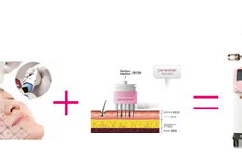 私密射频作用,重塑美丽，守护私密健康